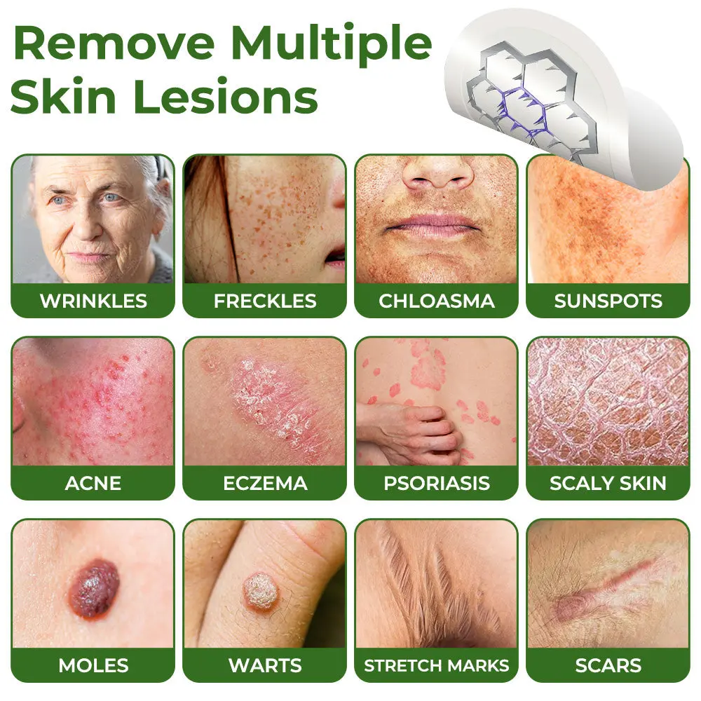 Magnesium MicroNeedle Quick Remove Skin Tag Patches - Image 2