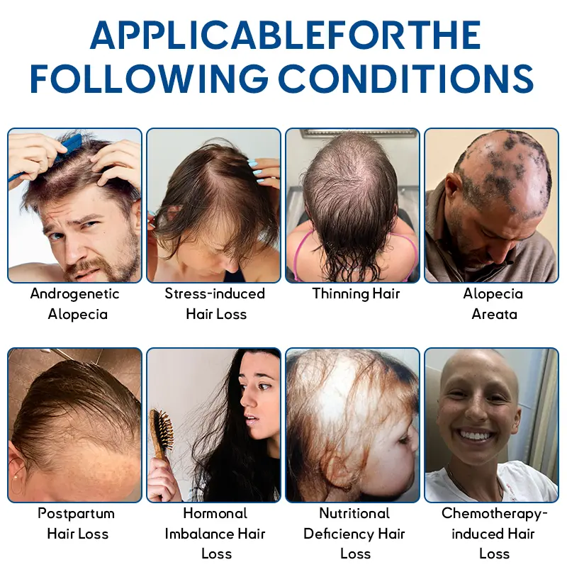 STEM Cell Hair Cycle Roller - Image 3