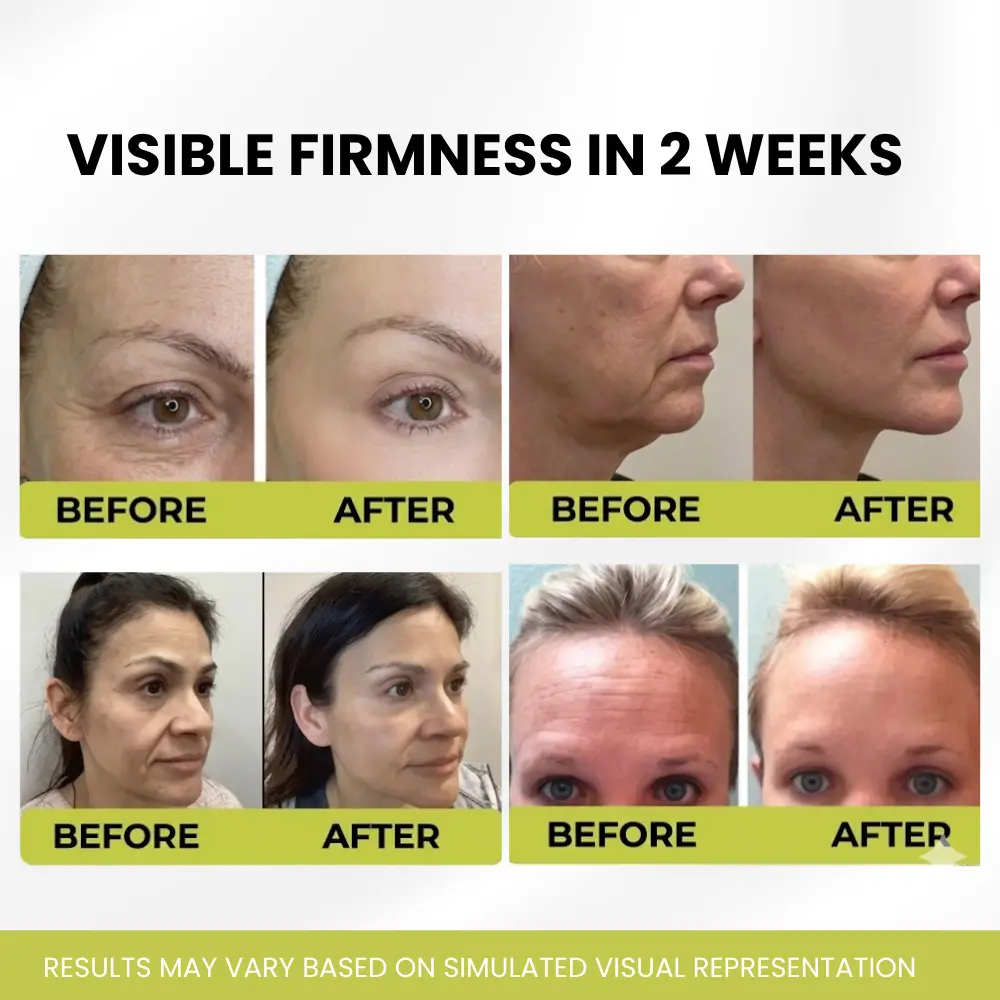 Turn Back 10 Years of Aging Without a Single Needle - Image 3