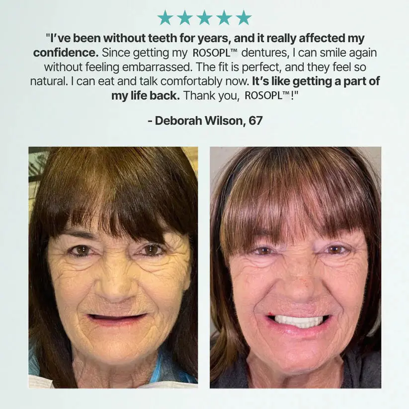Medical Full Denture with Strong Suctiond Custom-Fit Full Functional Dentures - Image 10