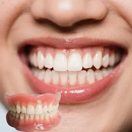 Medical Full Denture with Strong Suctiond Custom-Fit Full Functional Dentures - Image 3