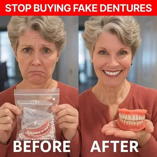 Medical Full Denture with Strong Suctiond Custom-Fit Full Functional Dentures - Image 4