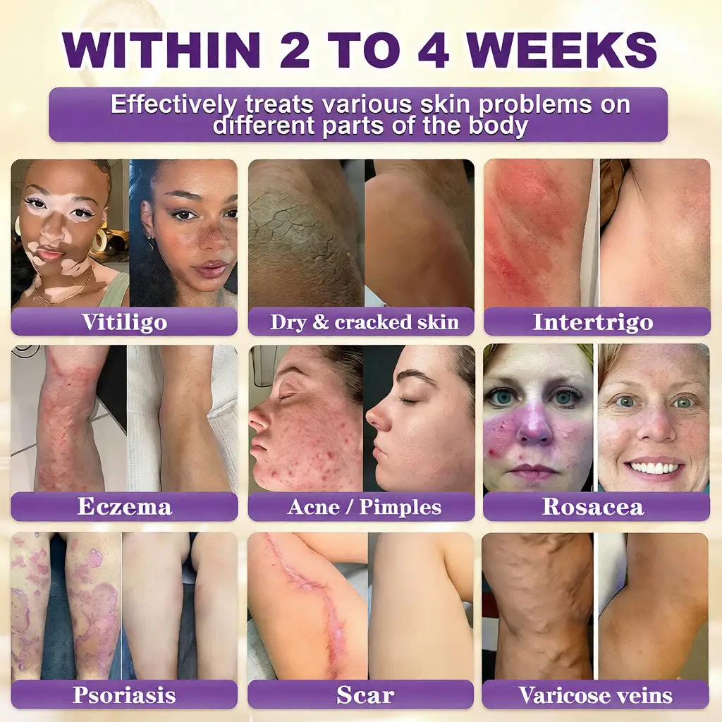 10-in-1 Biotin Skin Restoration Cream - Image 2