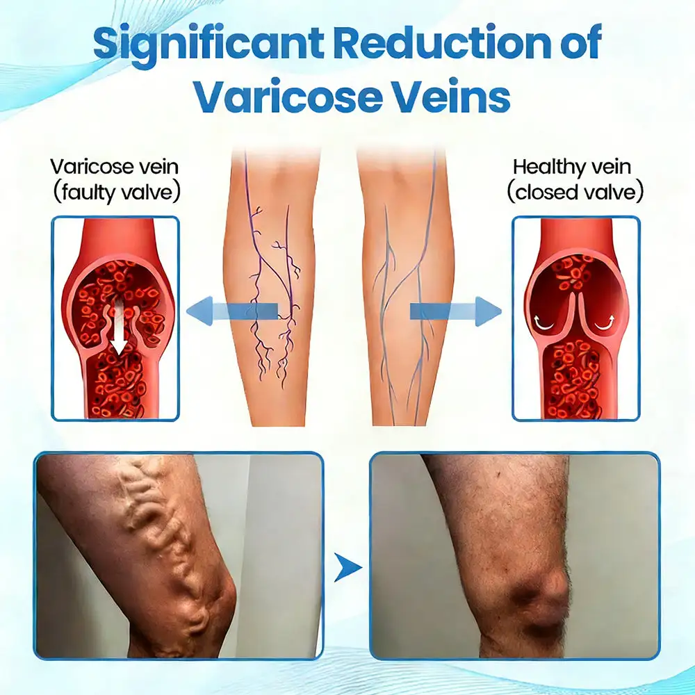 Advanced Vein Healing Spray - Image 10