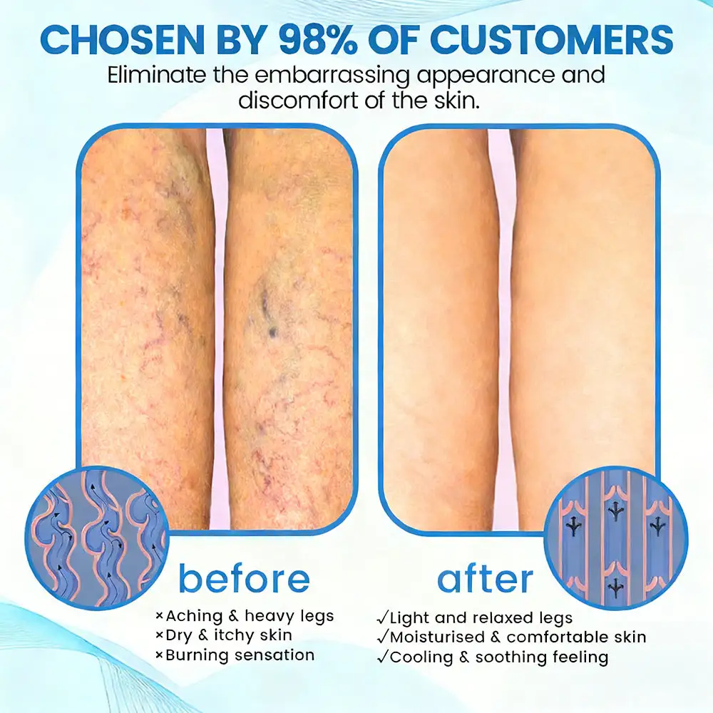 Advanced Vein Healing Spray - Image 6