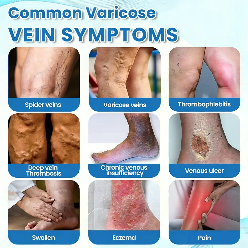 Advanced Vein Healing Spray - Image 8