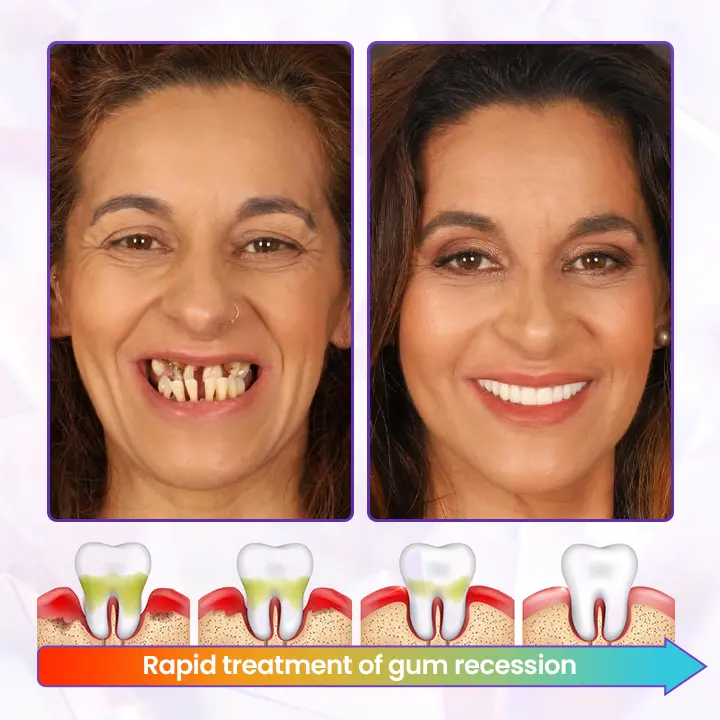 BeeRenew Advanced Gum Healing Toothpaste - Image 2