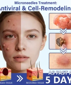 DermalRepair 2-in-1 Microneedle & Hydrocolloid Patch