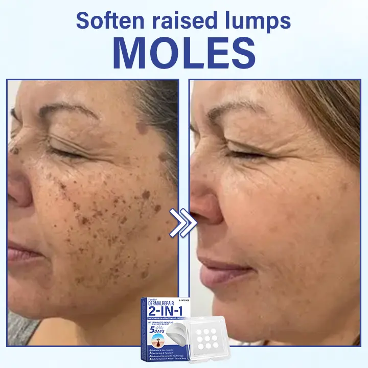 DermalRepair 2-in-1 Microneedle & Hydrocolloid Patch - Image 2