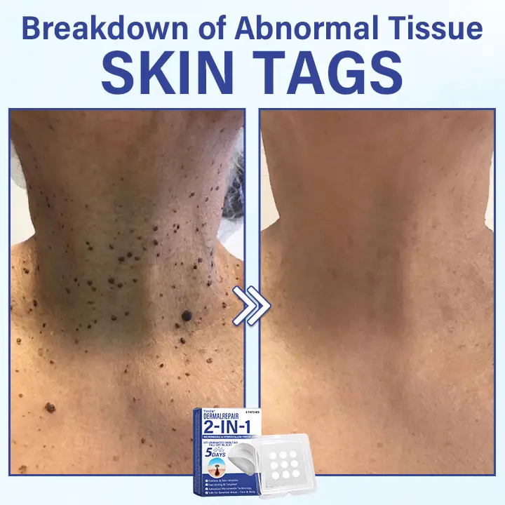 DermalRepair 2-in-1 Microneedle & Hydrocolloid Patch - Image 3