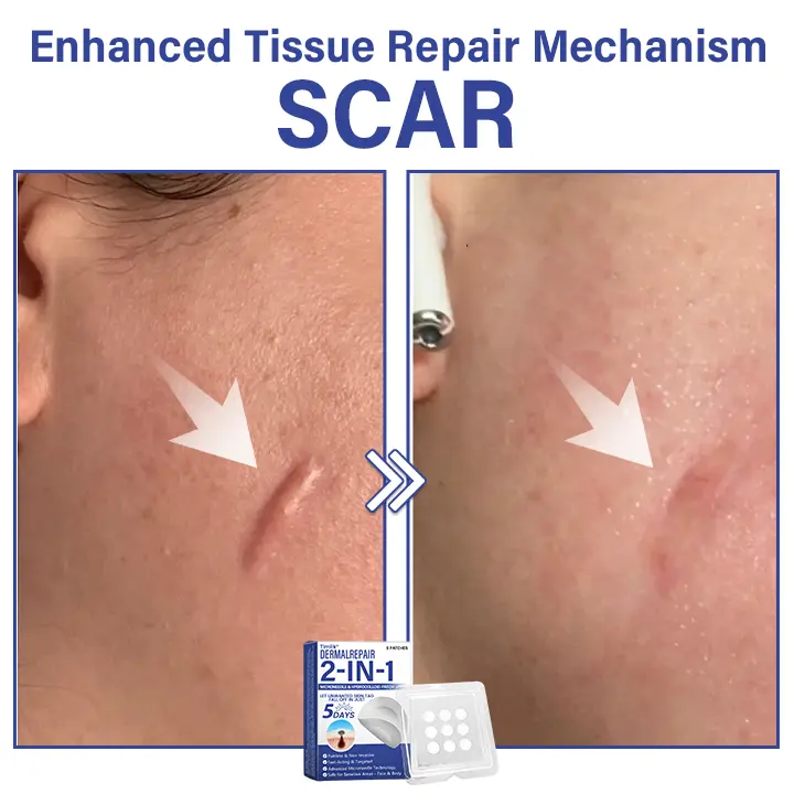 DermalRepair 2-in-1 Microneedle & Hydrocolloid Patch - Image 5