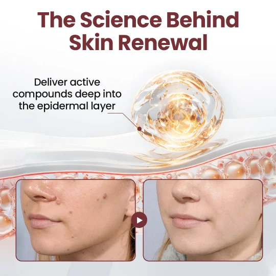 KeraErase Dual-Action Renewal Cream - Image 2
