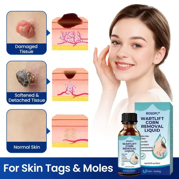 Removal Fluid - Image 2