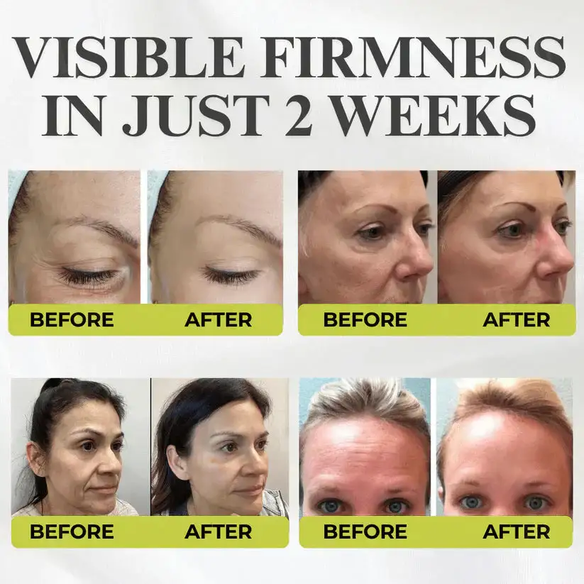 Advanced Peptide Botox-Style + Vita-A Retinol Lifting Renewal Cream - Image 7
