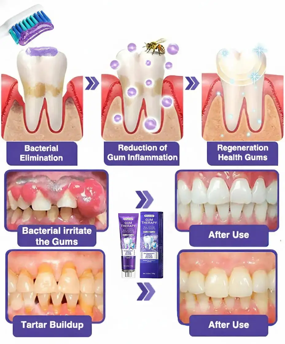 Bee Venom Dental Treatment Toothpaste - Image 11