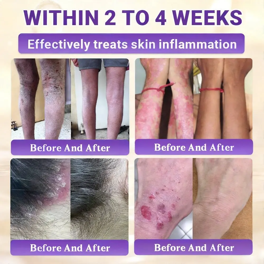 Biotin 10-in-1 Skin Restoration Cream - Image 3