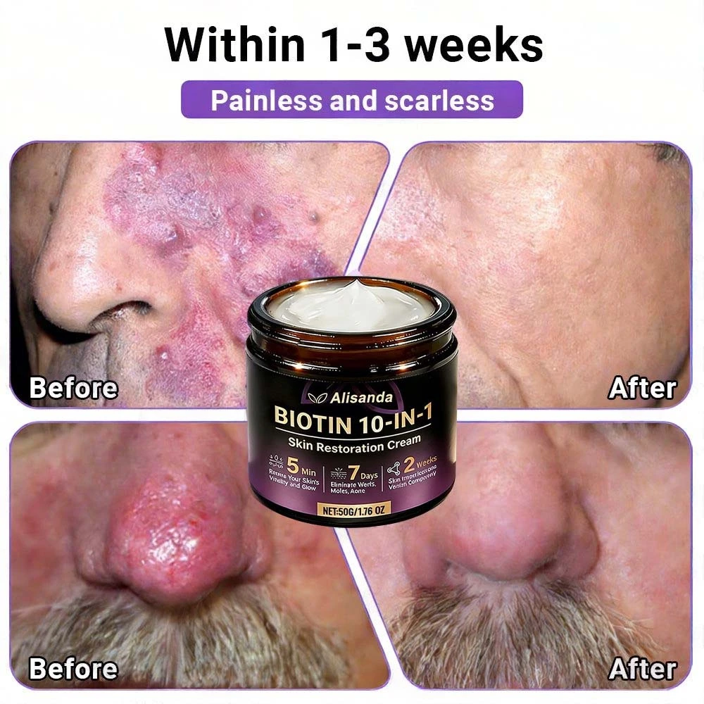 Biotin 10-in-1 Skin Restoration Cream - Image 6