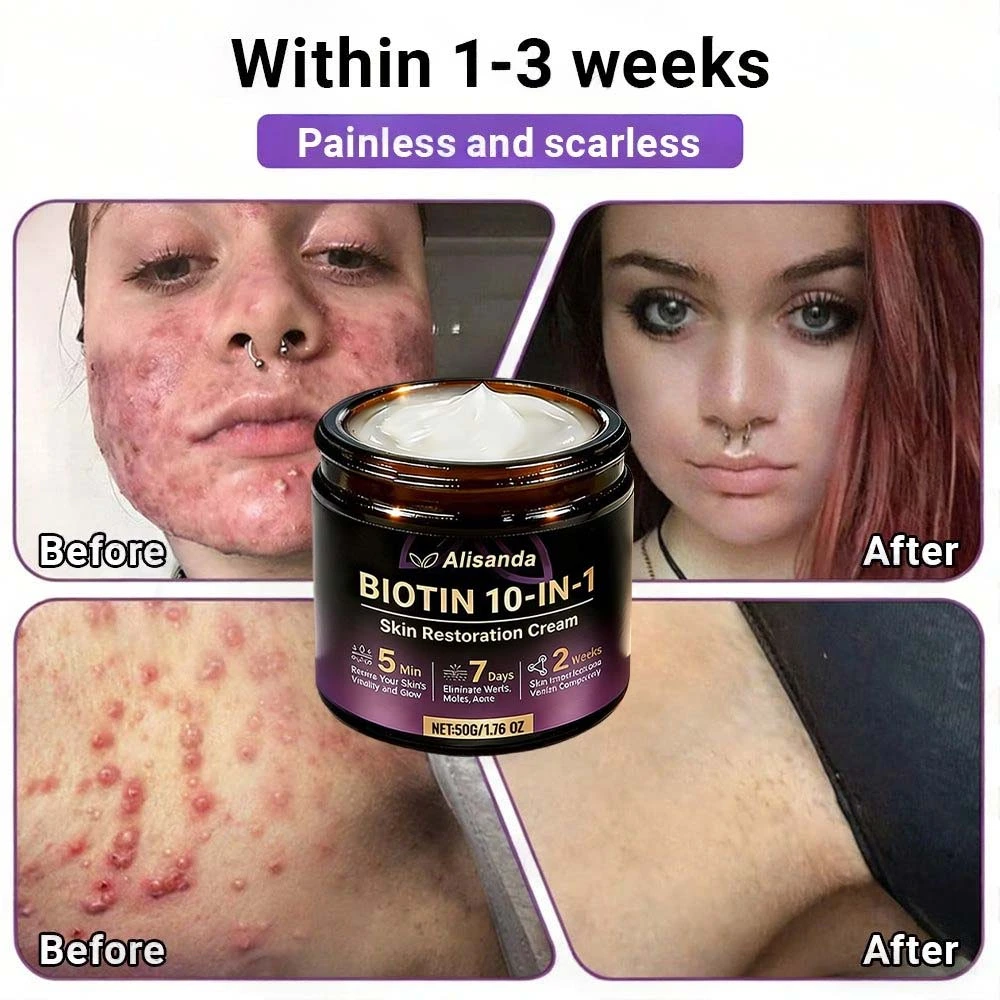 Biotin 10-in-1 Skin Restoration Cream - Image 7