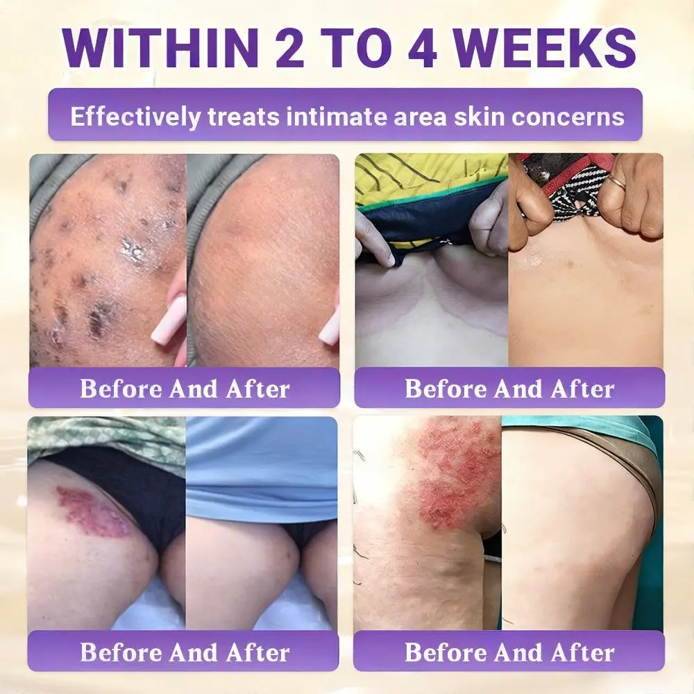Biotin 10-in-1 Skin Restoration Cream - Image 8