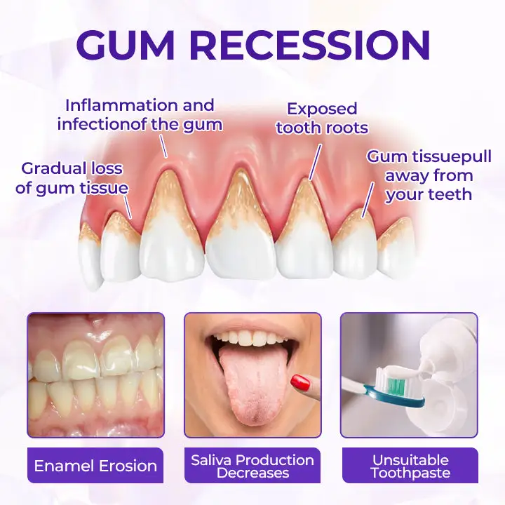 SensiGum Fluoride Toothpaste - Image 17