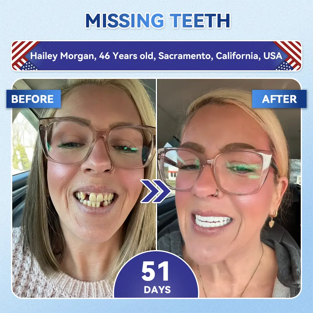 Fast‑Dissolving Tooth & Gum Repair Oral Strips - Image 6