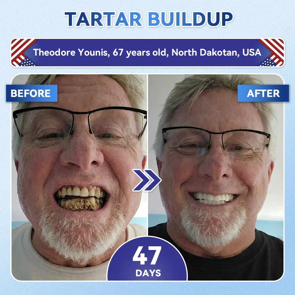 Fast‑Dissolving Tooth & Gum Repair Oral Strips - Image 7