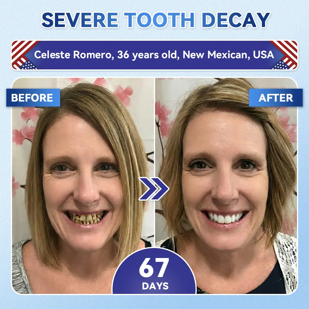 Fast‑Dissolving Tooth & Gum Repair Oral Strips - Image 8