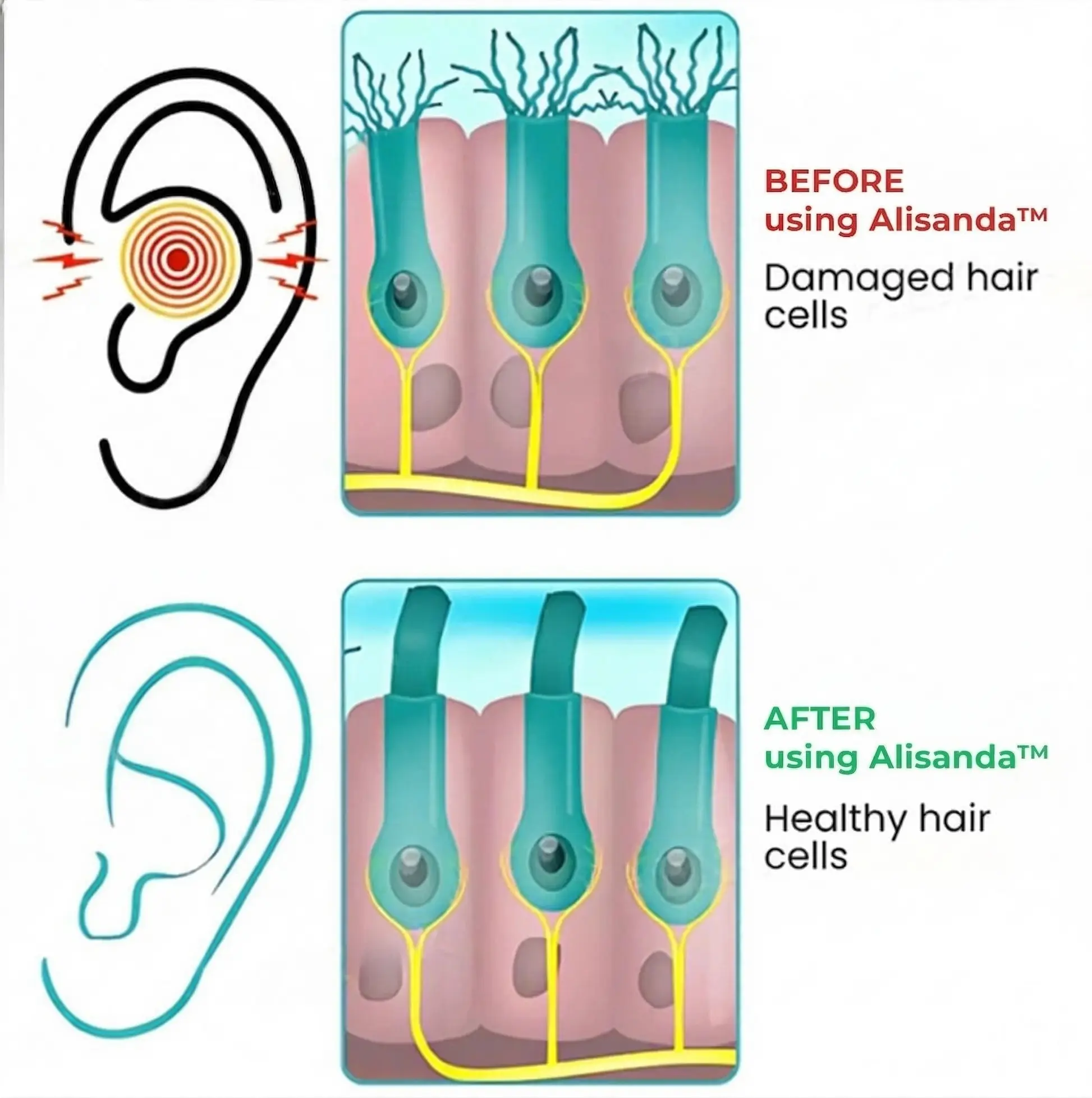 Tinnitus Relieving Device - Image 8