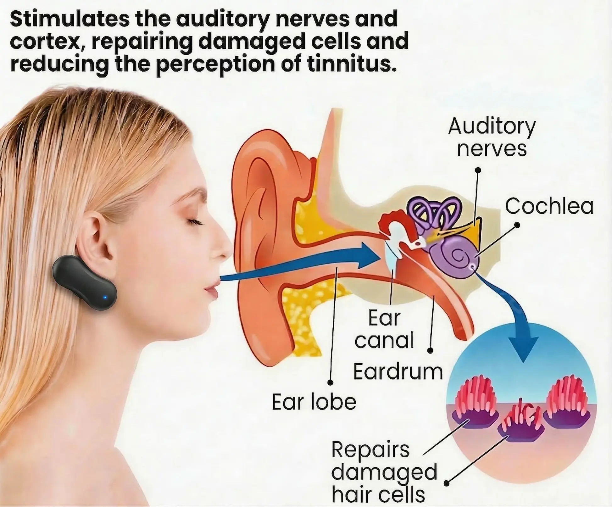 Tinnitus Relieving Device - Image 3
