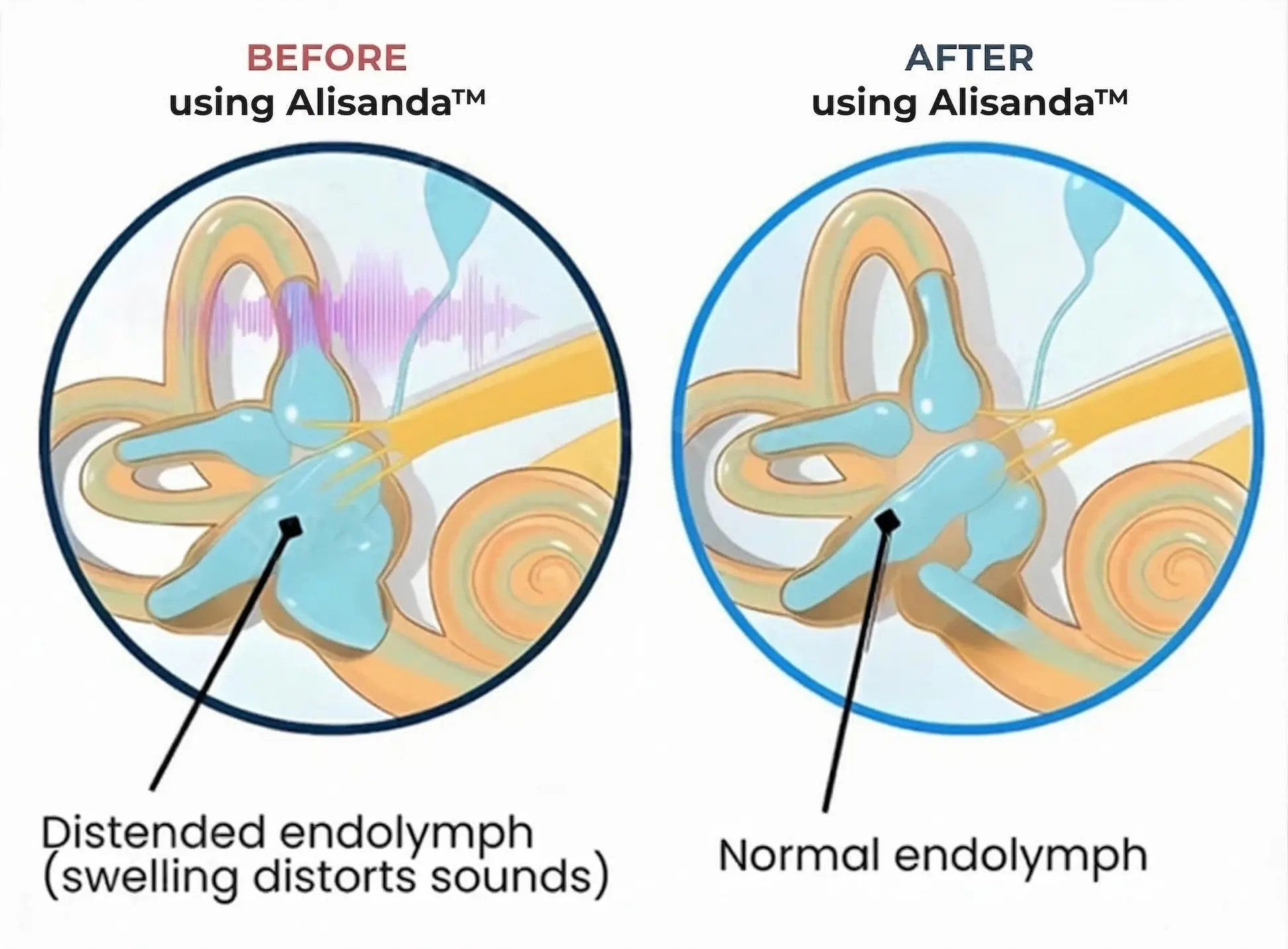 Tinnitus Relieving Device - Image 7