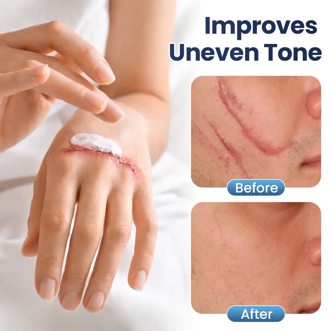 DermaFix Texture Repair Gel - Image 5