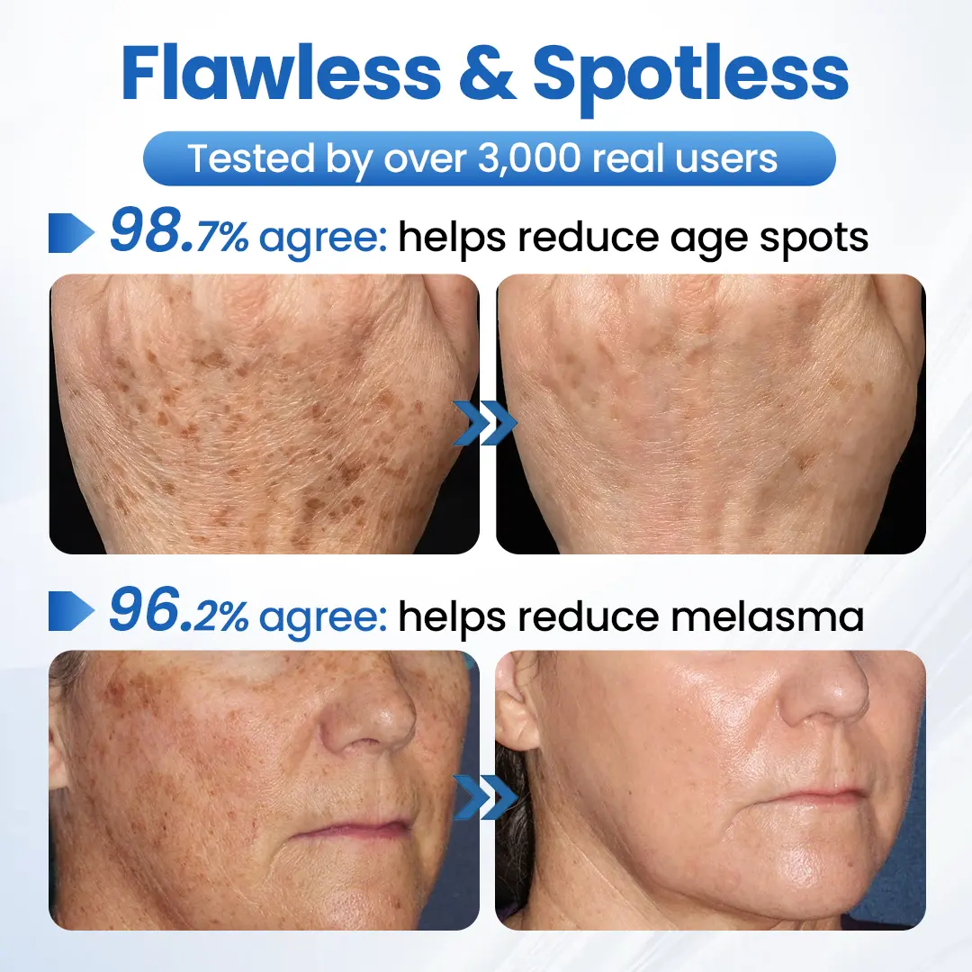 GlowFade Brightening & Spot-Removing Mask - Image 2