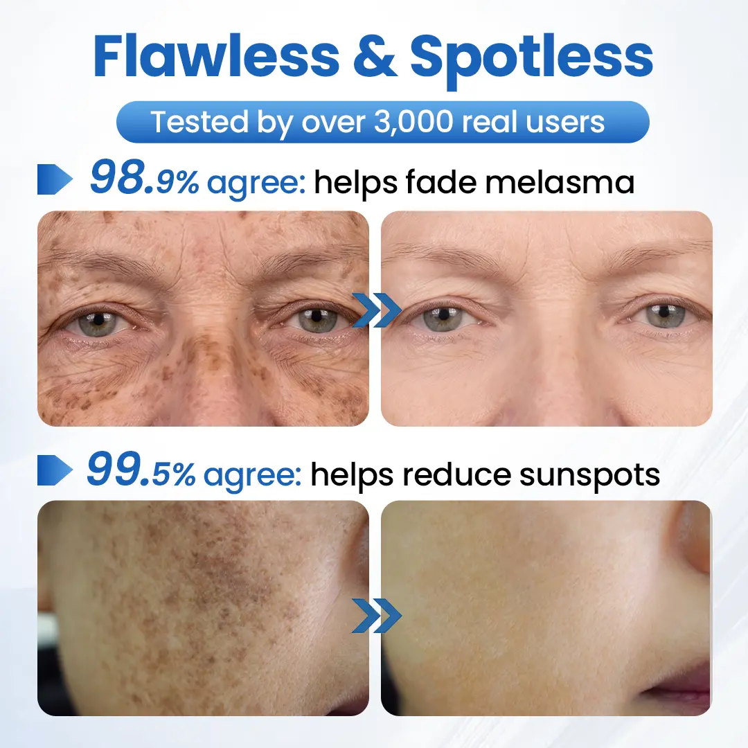 GlowFade Brightening & Spot-Removing Mask - Image 3