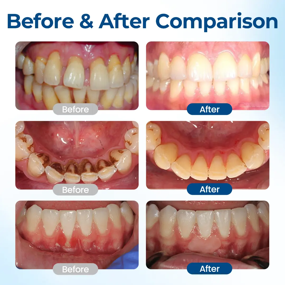 GumHoney Oral Repair Drops - Image 3