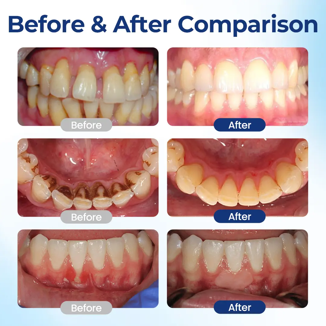 GumViva Oral Repair Solution - Image 3