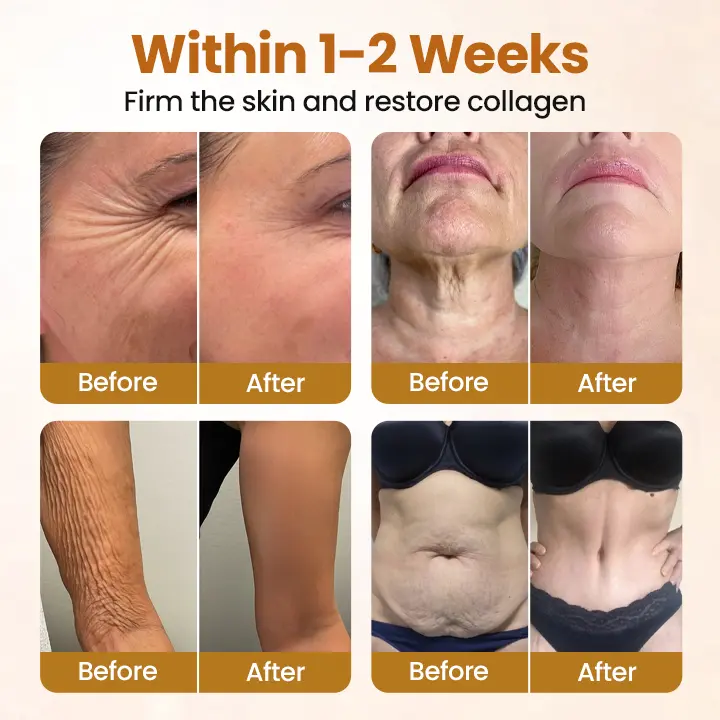 SeraLift Collagen Peptide Firming Mist - Image 6