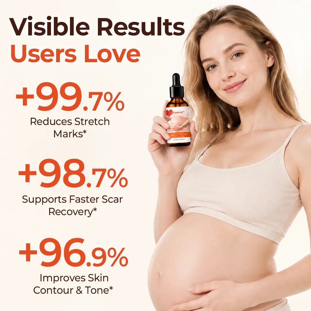 SilkStretch Natural Stretch Mark & Scar Oil - Image 5