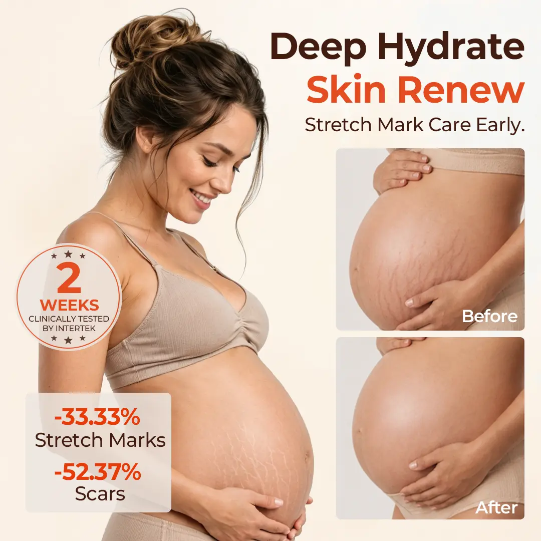 SilkStretch Natural Stretch Mark & Scar Oil - Image 8