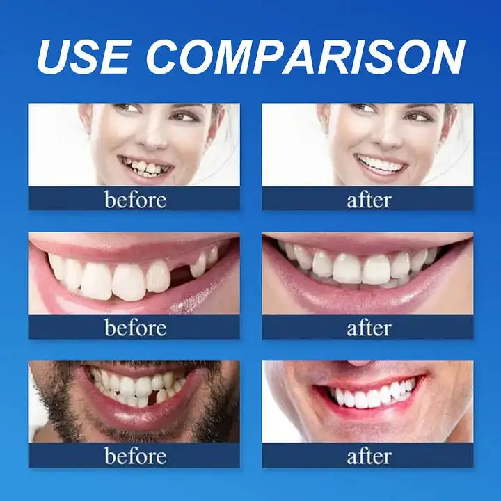 --Advanced Customized Full Denture Set - Image 12