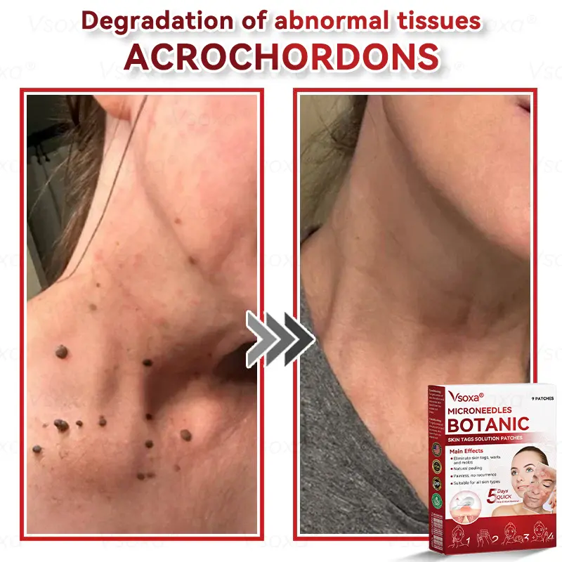 Botanical Skin Solution Patches - Image 5