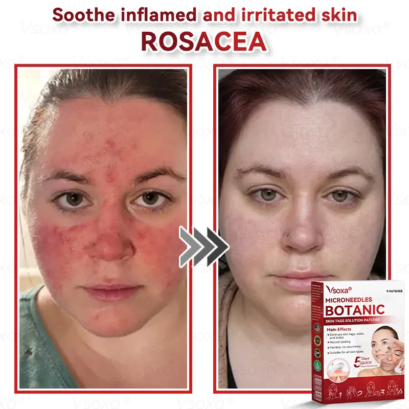 Botanical Skin Solution Patches - Image 6