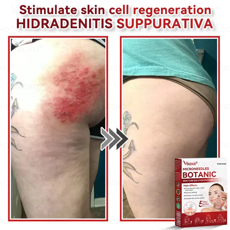 Botanical Skin Solution Patches - Image 8