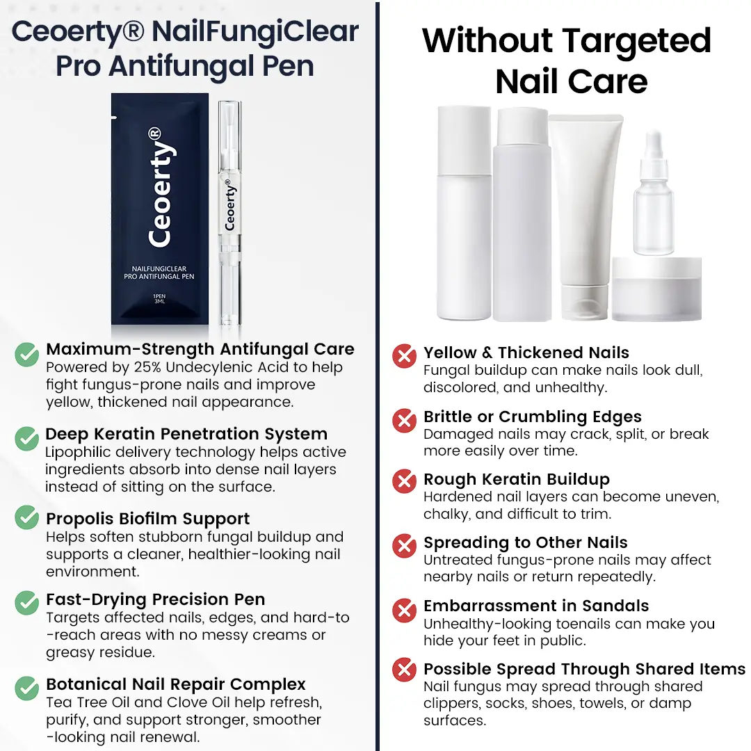 NailFungiClear Pro Antifungal Pen - Image 9