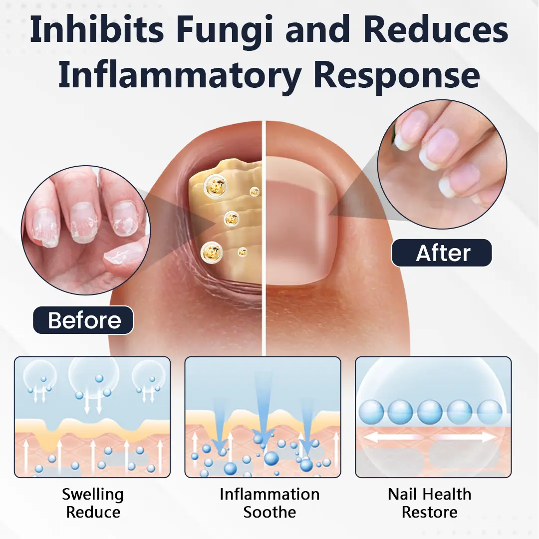 NailFungiClear Pro Antifungal Pen - Image 4
