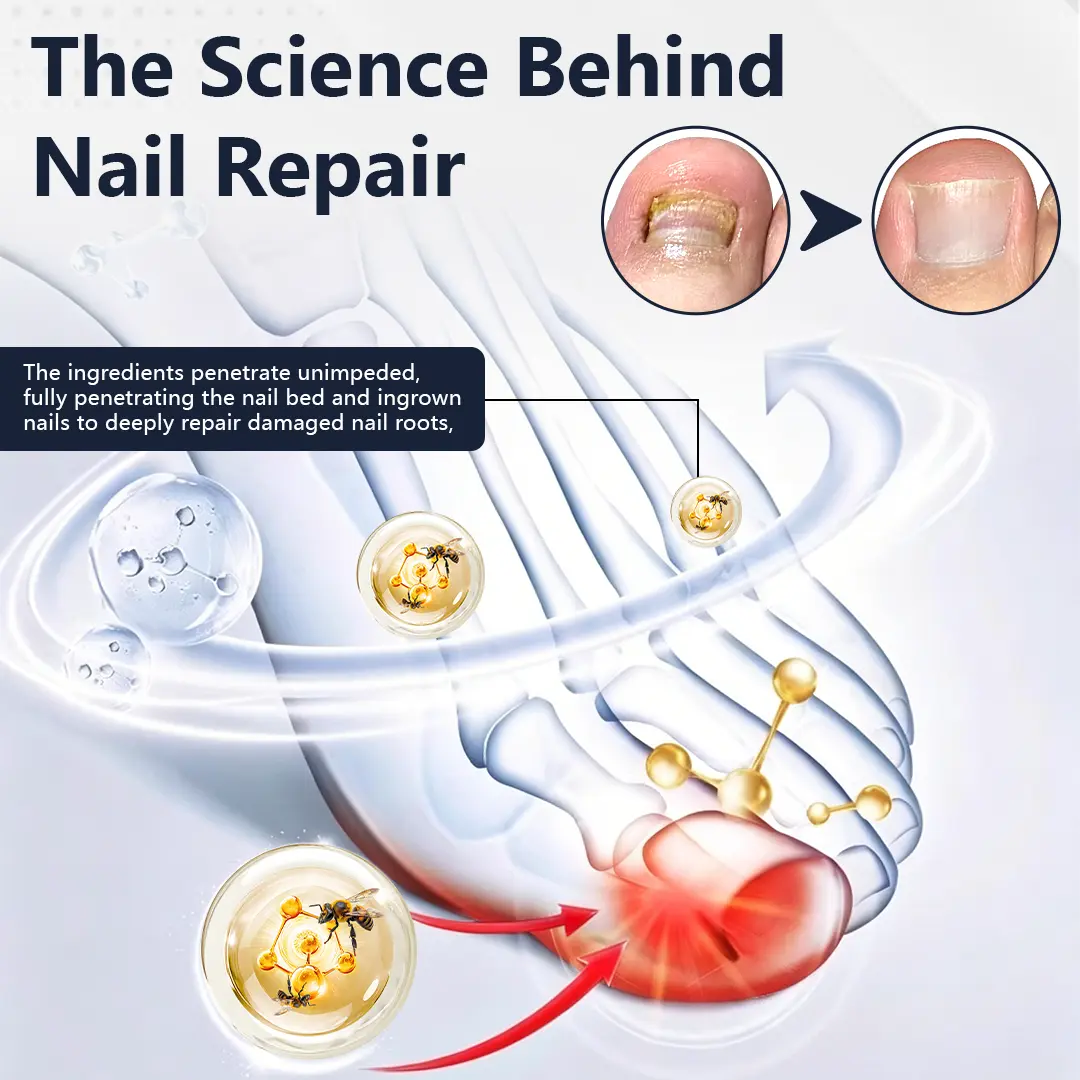 NailFungiClear Pro Antifungal Pen - Image 7