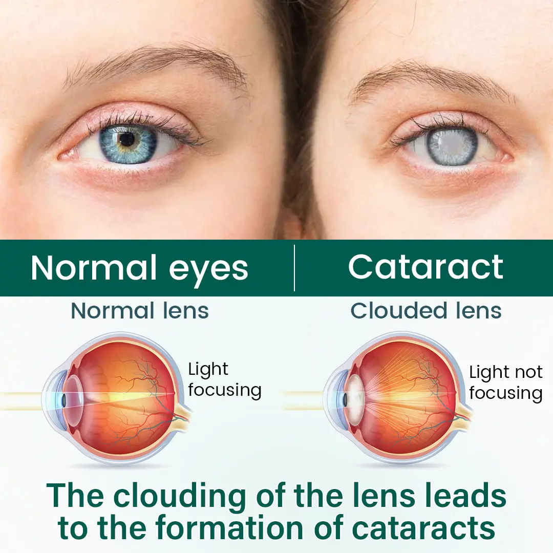 OptiClear Nano Eye Roller Serum - Image 4