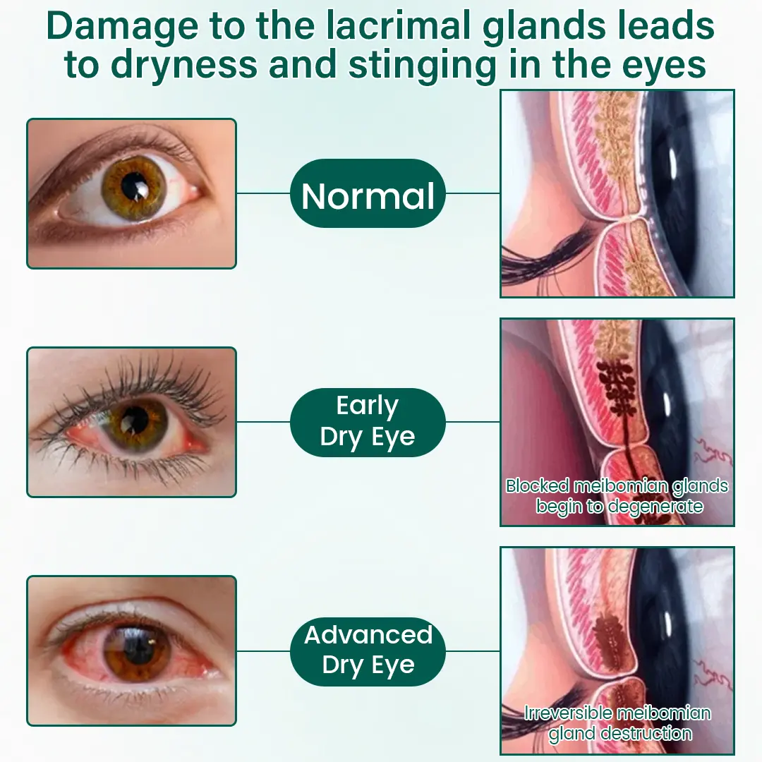 OptiClear Nano Eye Roller Serum - Image 6