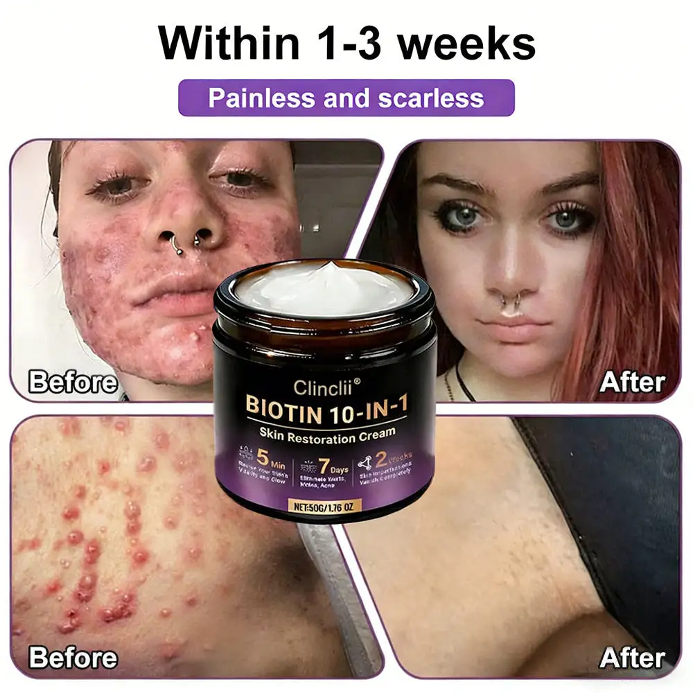 Biotin 10-in-1 Skin Restoration Cream - Image 7