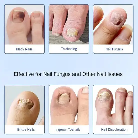 Clinclii Nail Patches-Suitable for Solving Nails - Image 5