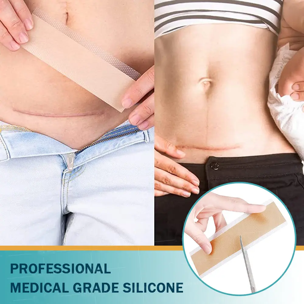 Hyaluronic Acid Nano Repair Tape - Image 12
